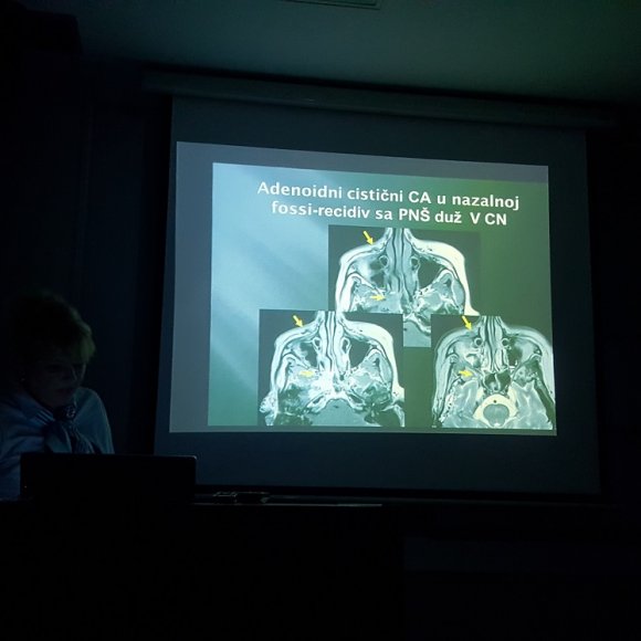 ODRŽAN JEDNODNEVNI SEMINAR – “Savremeni neuroradiološki imidžing”